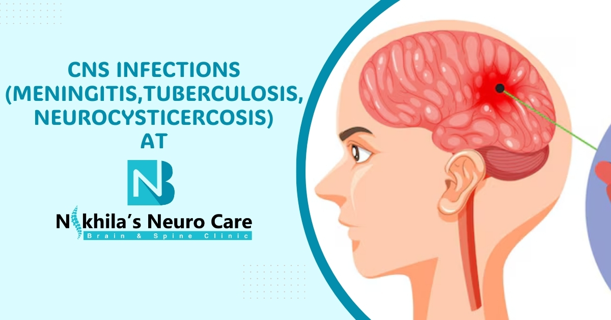 Cns infections (meningitis,Tuberculosis, Neurocysticercosis)