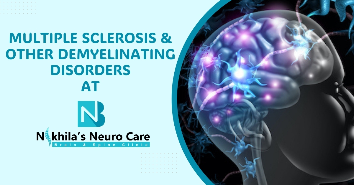 Multiple sclerosis & other demyelinating disorders