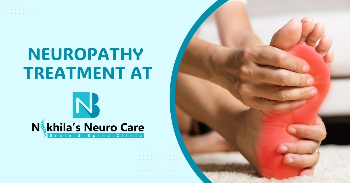 Neuropathy treatment in ECIL