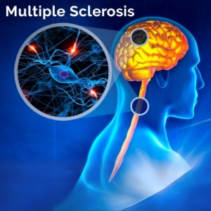 multiple sclerosis specialist doctor near me